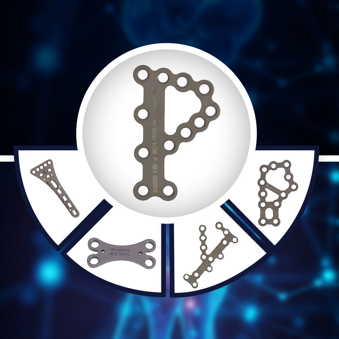 Hand , Foot & Ankle System Manufacturers in 